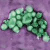 Influenza gyanús betegek a szegedi kórházban