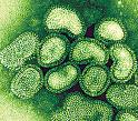 H1N1: Szegeden ismét nőtt az elhunytak száma