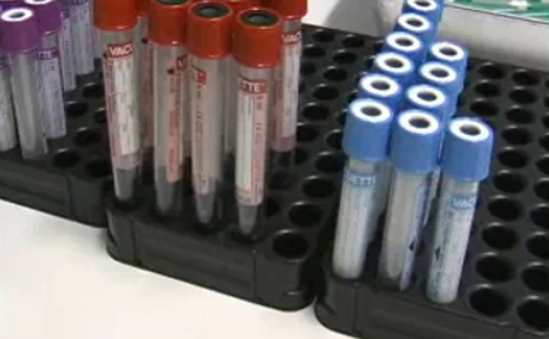 Román-magyar együttműködés az újszülöttkori szűrés érdekében