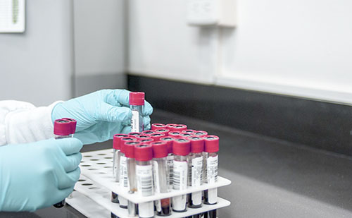 Szegeden alakítják ki Közép-Európa legmodernebb biobankját